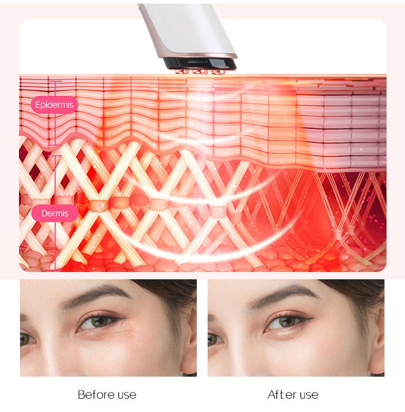 Eye Care Beauty Device