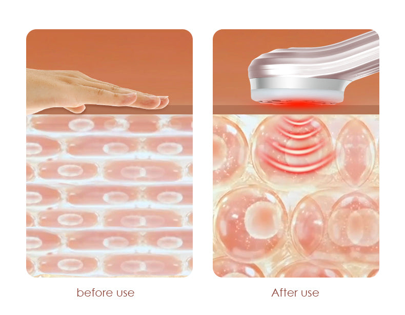 Multifunctional Beauty Device