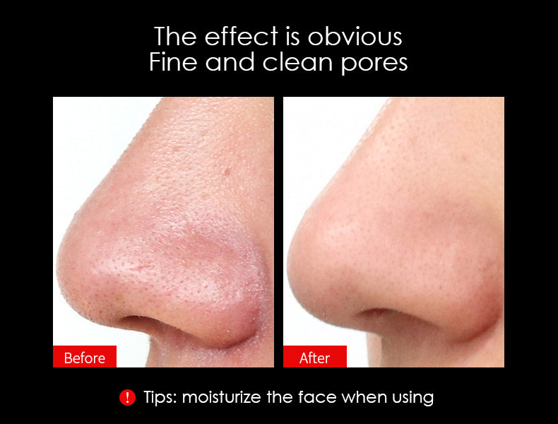 Multifunctional Beauty Device